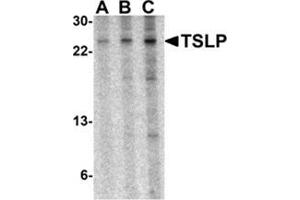 Western blot analysis of TSLP in A-20 cell lysate with AP30965PU-N TSLP antibody at 0.