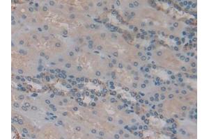 IHC-P analysis of Human Kidney Tissue, with DAB staining. (IGFBP6 Antikörper  (AA 31-240))