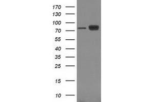 Image no. 5 for anti-Catenin (Cadherin-Associated Protein), beta 1, 88kDa (CTNNB1) antibody (ABIN1496890) (CTNNB1 Antikörper)