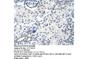 Rabbit Anti-SNRPA Antibody  Paraffin Embedded Tissue: Human Kidney Cellular Data: Epithelial cells of renal tubule Antibody Concentration: 4. (SNRPA1 Antikörper  (Middle Region))
