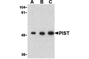 Western Blotting (WB) image for anti-Golgi-Associated PDZ and Coiled-Coil Motif Containing (GOPC) (C-Term) antibody (ABIN1030588)