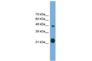 WB Suggested Anti-RAB37 Antibody Titration: 0. (RAB37 Antikörper  (Middle Region))
