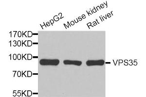 Western blot analysis of extracts of various cell lines, using VPS35 antibody. (VPS35 Antikörper)