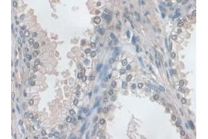 Immunohistochemistry (IHC) image for anti-Ezrin (EZR) (AA 1-295) antibody (ABIN7440074)
