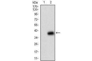 Fig. (beta-2 Microglobulin Antikörper  (AA 21-100))
