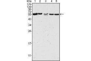 Western blot analysis using PAK2 mouse mAb against Hela (1), Jurkat (2), A549 (3), HEK293 (4) and K562 (5) cell lysate. (PAK2 Antikörper)