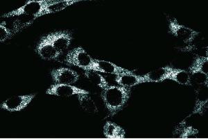 Immunoflourescence staining of RSV-3T3 cells. (NEDD4 Antikörper  (AA 173-262))