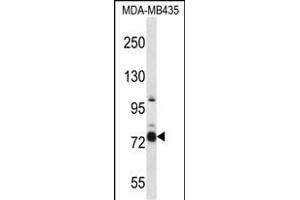 CASS4 Antibody (C-term) (ABIN657438 and ABIN2846469) western blot analysis in MDA-M cell line lysates (35 μg/lane). (CASS4 Antikörper  (C-Term))