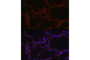 Immunofluorescence (IF) image for anti-Solute Carrier Family 39 (Zinc Transporter), Member 14 (SLC39A14) (AA 240-340) antibody (ABIN6147993)