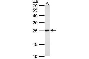 WB Image NDUFV2 antibody detects NDUFV2 protein by Western blot analysis. (NDUFV2 Antikörper  (Center))