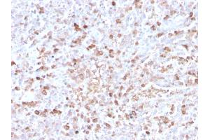 Formalin-fixed, paraffin-embedded human spleen stained with Lambda Light Chain Recombinant Rabbit Monoclonal Antibody (LLC/3778R). (Rekombinanter IgL Antikörper)