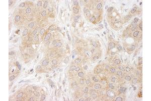 Immunohistochemistry (IHC) image for anti-Sorting Nexin 1 (SNX1) (C-Term) antibody (ABIN7448807)
