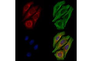 ABIN6261181 and ABIN6278835 staining Hela cells by IF/ICC.