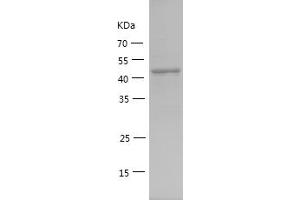Western Blotting (WB) image for Cytochrome C Oxidase Subunit IV Isoform 1 (COX4I1) (AA 1-169) protein (GST tag) (ABIN7122572) (COX IV Protein (AA 1-169) (GST tag))