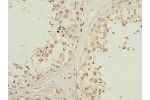 Immunohistochemistry of paraffin-embedded human testis tissue using ABIN7163172 at dilution of 1:100 (PIK3R3 Antikörper  (Regulatory Subunit Gamma))