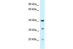 Image no. 1 for anti-Galactokinase 1 (GALK1) (AA 219-268) antibody (ABIN6747604) (GALK1 Antikörper  (AA 219-268))