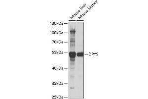 Western blot analysis of extracts of various cell lines, using DPYS antibody (ABIN6127809, ABIN6139809, ABIN6139810 and ABIN6221986) at 1:1000 dilution. (DPYS Antikörper  (AA 250-519))