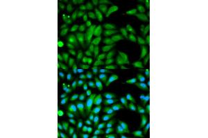 Immunofluorescence analysis of HeLa cells using PARK2 antibody (ABIN5970356). (Parkin Antikörper)