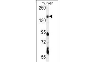 Western blot analysis in mouse liver tissue lysates (35ug/lane). (PIK3C2A Antikörper  (C-Term))