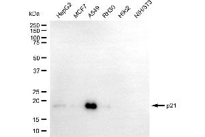 Western blotting analysis using p21 antibody (ABIN7798222). (Rekombinanter p21 Antikörper)