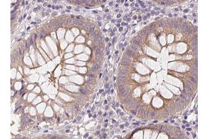 Phospho-AMPK alpha (Thr172) Antibody for IHC in human colon. (AMPK alpha Antikörper  (pThr172))