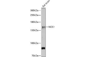 Western blot analysis of extracts of Rat brain, using NOS1 antibody (ABIN6129512, ABIN6144725, ABIN6144726 and ABIN6216548) at 1:500 dilution. (NOS1 Antikörper  (AA 1-180))