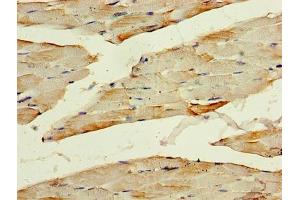 Immunohistochemistry of paraffin-embedded human skeletal muscle tissue using ABIN7142079 at dilution of 1:100 (PHPT1 Antikörper  (AA 1-125))