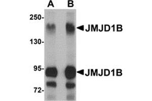 Western Blotting (WB) image for anti-Lysine (K)-Specific Demethylase 3B (KDM3B) (Middle Region) antibody (ABIN1030967)