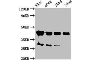 Western Blot Positive WB detected in Recombinant protein All lanes: olig2 antibody at 2 μg/mL Secondary Goat polyclonal to rabbit IgG at 1/50000 dilution Predicted band size: 44 kDa Observed band size: 44 kDa (OLIG2 Antikörper  (AA 150-273))