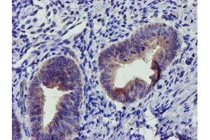 Immunohistochemical staining of paraffin-embedded Human endometrium tissue using anti-SOCS3 mouse monoclonal antibody. (SOCS3 Antikörper)
