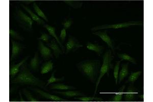 Immunofluorescence of monoclonal antibody to EIF4G2 on HeLa cell. (EIF4G2 Antikörper  (AA 811-889))