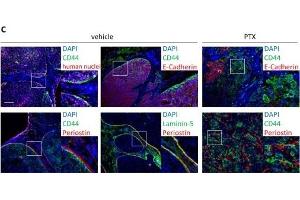 Immunofluorescence (Paraffin-embedded Sections) (IF (p)) image for anti-Periostin (POSTN) (C-Term) antibody (ABIN2854805)