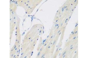 Immunohistochemistry of paraffin-embedded Mouse heart using CCL26 Polyclonal Antibody at dilution of 1:200 (40x lens). (CCL26 Antikörper)