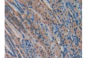 Figure. (CYR61 Antikörper  (AA 176-379))