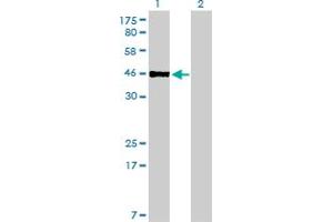 Western Blot analysis of PBX2 expression in transfected 293T cell line by PBX2 monoclonal antibody (M01), clone 2E9.