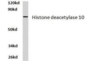 Image no. 2 for anti-Histone Deacetylase 10 (HDAC10) antibody (ABIN265454) (HDAC10 Antikörper)
