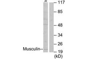 Western blot analysis of extracts from Jurkat cells, using Musculin Antibody. (Musculin Antikörper  (AA 131-180))