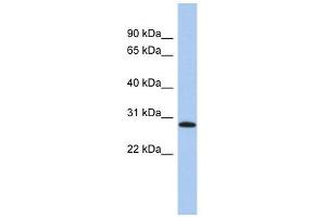 LYSMD1 antibody used at 1 ug/ml to detect target protein. (LYSMD1 Antikörper  (N-Term))