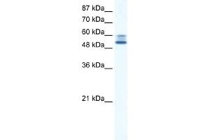 WB Suggested Anti-JMJD2D Antibody Titration:  5. (JMJD2D Antikörper  (C-Term))