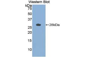 Western blot analysis of the recombinant protein. (Cathepsin S Antikörper  (AA 115-331))