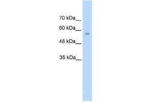 DDC antibody used at 5 ug/ml to detect target protein.