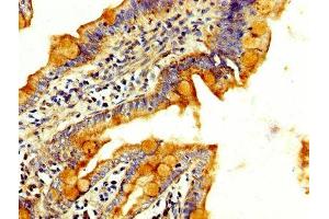 Immunohistochemistry (IHC) image for anti-RAB3 GTPase Activating Protein Subunit 2 (Non-Catalytic) (RAB3GAP2) (AA 277-387), (Catalytic Subunit) antibody (ABIN7166997)