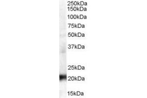 Western Blotting (WB) image for anti-Coiled-Coil Domain Containing 176 (CCDC176) (N-Term) antibody (ABIN2791196) (C14orf45 Antikörper  (N-Term))