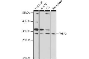 Western blot analysis of extracts of various cell lines, using WBP2 antibody (ABIN7271391) at 1:1000 dilution. (WBP2 Antikörper  (AA 15-140))