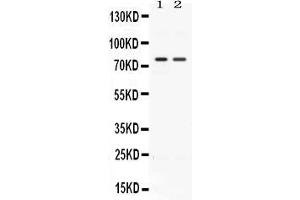 Western blot analysis of ACVR2A expression in rat kidney extract ( Lane 1) and HELA whole cell lysates ( Lane 2). (ACVR2A Antikörper  (AA 421-513))