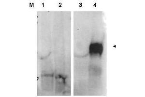 Western blot using  affinity purified anti-FAP antibody shows detection of FAP protein in whole cell lysates from FAP expressing HEK cells (lane 4) but not control HEK cells (lane 3). (FAP Antikörper  (Internal Region))
