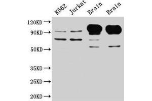 Western Blot Positive WB detected in: K562 whole cell lysate, Jurkat whole cell lysate, Rat brain tissue, Mouse brain tissue All lanes: MAG antibody at 5 μg/mL Secondary Goat polyclonal to rabbit IgG at 1/50000 dilution Predicted band size: 70, 64, 67 kDa Observed band size: 70, 100 kDa (MAG Antikörper  (AA 25-516))