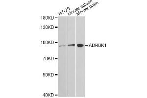 Western blot analysis of extracts of various cell lines, using ADRBK1 antibody. (GRK2 Antikörper)