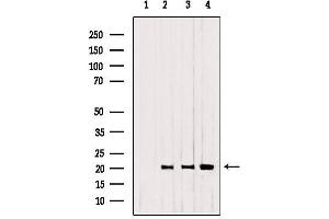 Western blot analysis of extracts from 293，B16F10，Mouse myeloma, using CNPY2,MSAP antibody. (CNPY2/MSAP Antikörper  (C-Term))