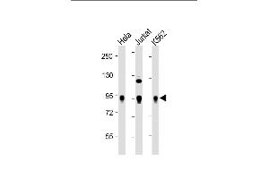 All lanes : Anti-Wee1 Antibody at 1:2000 dilution Lane 1: Hela whole cell lysate Lane 2: Jurkat whole cell lysate Lane 3: K562 whole cell lysate Lysates/proteins at 20 μg per lane. (WEE1 Antikörper  (Ser123))